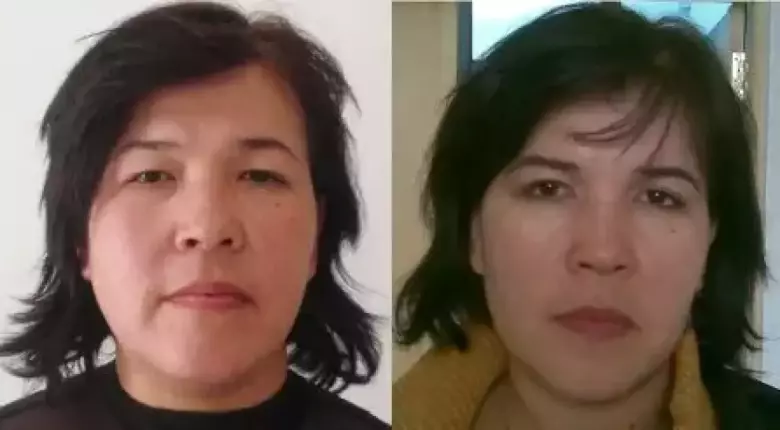 Пластические и косметические операции в клинике "MEDICANA"в Tашкенте