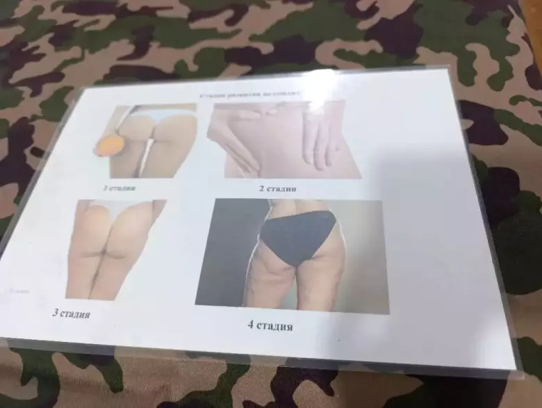 Массаж