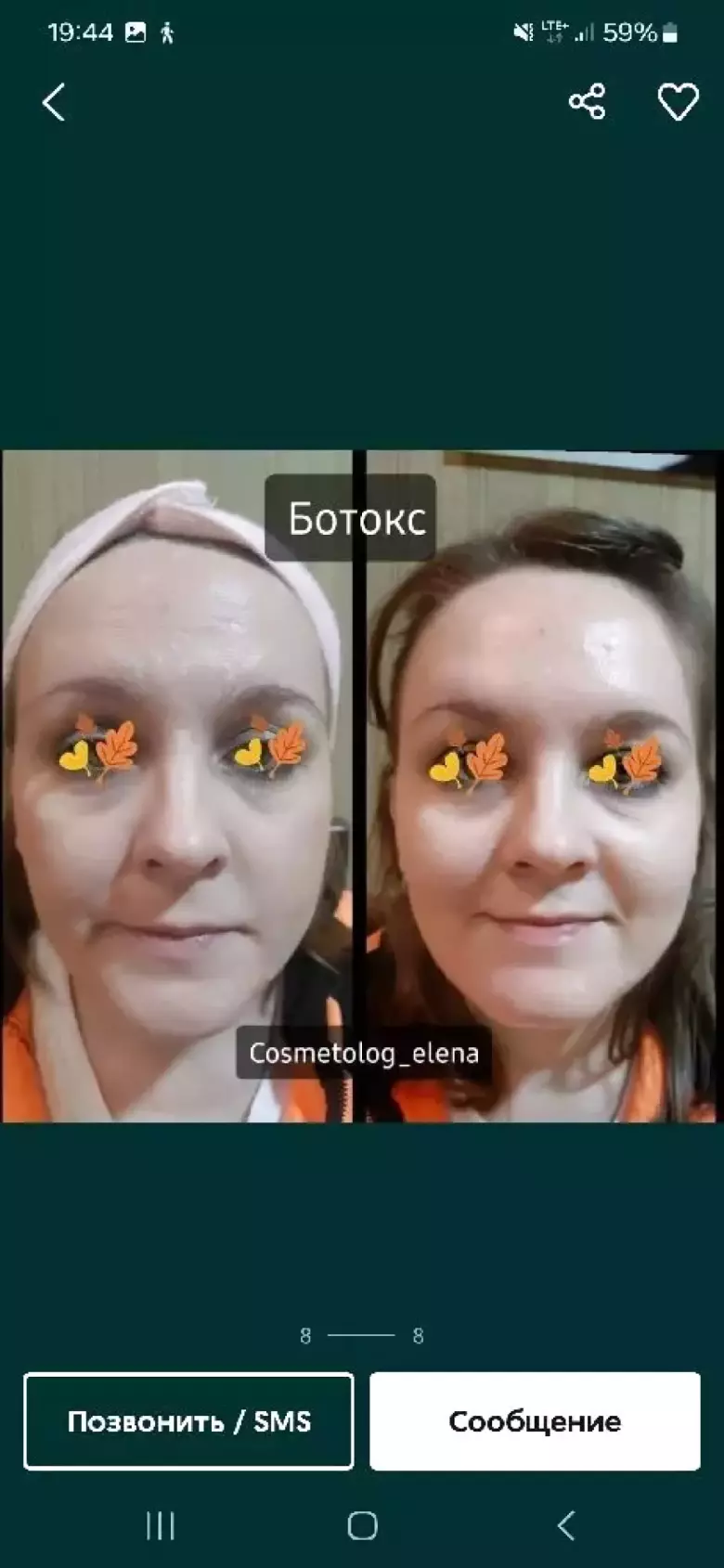 Нужны модели ботокс фулл фэйс все лицо+шея