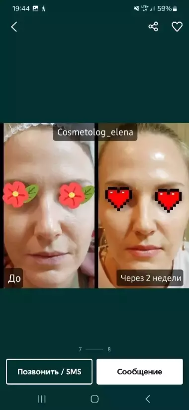 Нужны модели ботокс фулл фэйс все лицо+шея