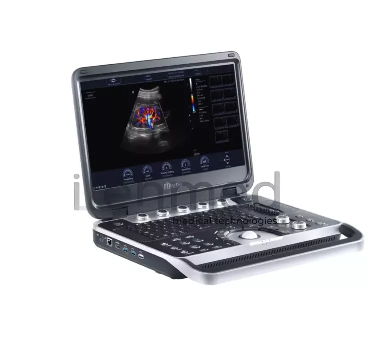 Портативная ультразвуковая диагностическая система Finus 50 с цветным доплером