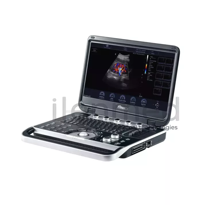 Портативная ультразвуковая диагностическая система Finus 50 с цветным доплером