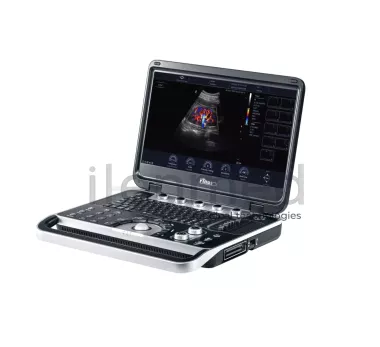 Портативная ультразвуковая диагностическая система Finus 50 с цветным доплером