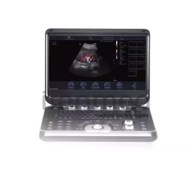 Портативная ультразвуковая диагностическая система Finus 50 с цветным доплером